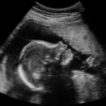 1531995894-cover-image-l