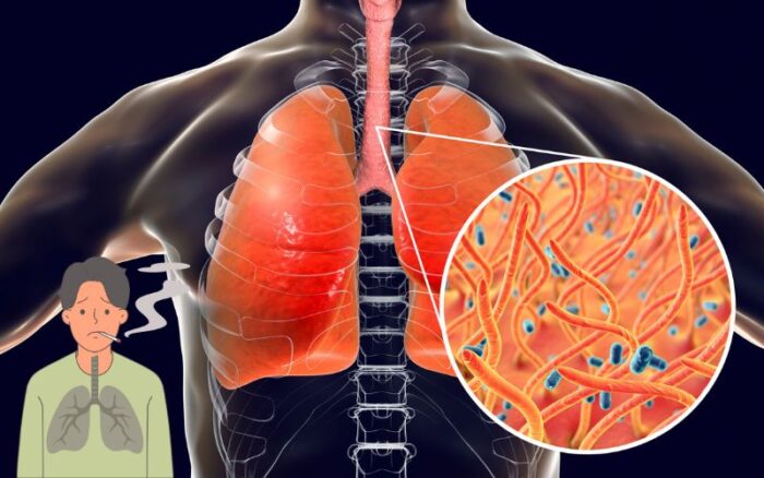 How to Naturally Clear Phlegm and Mucus from Chest and Throat